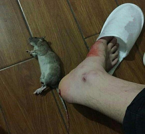 Nhập viện cấp cứu vì bị chuột cắn